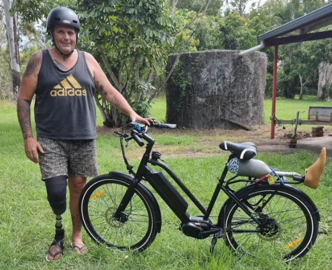 Customised eBike Brings Freedom to the Life of a Below-Knee Amputee